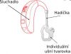 Oprava naslouchadel - služby pro sluchově postižené
